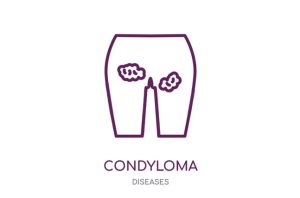 Read more about the article What is Condyloma and What You Can Do About it