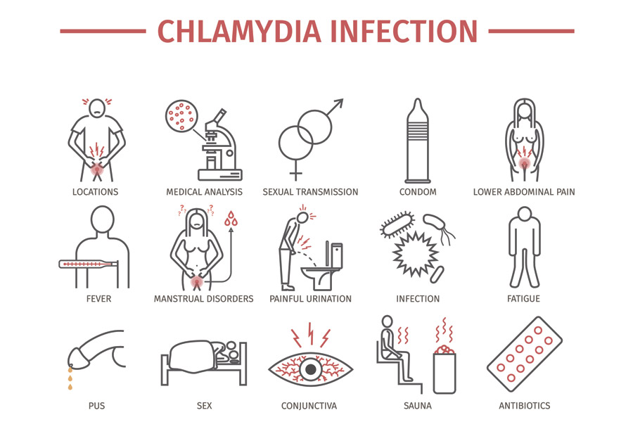 Chlamydia Infection